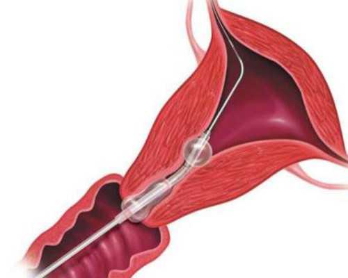 三亚台湾供卵,三亚供卵公司