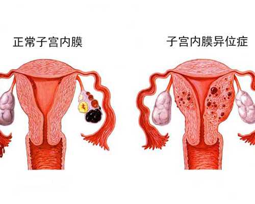 供卵试管机构_借卵试管多钱,重庆供卵试管经历,重庆试管供卵